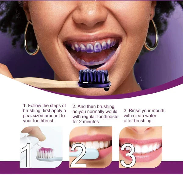 HiSmile V34 Teeth Whitening