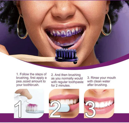 HiSmile V34 Teeth Whitening