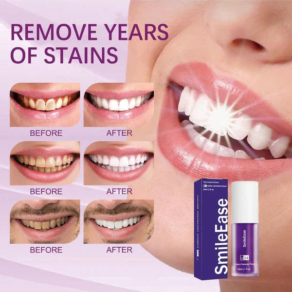 HiSmile V34 Teeth Whitening